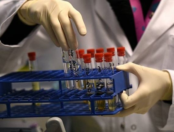 hoa-ky-xet-nghiem-mau